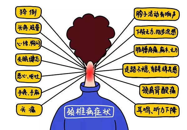 頸椎病癥狀