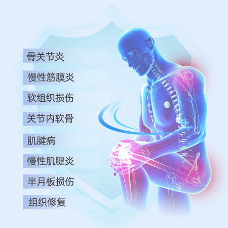 直樂(lè)PRP(富血小板血漿)關(guān)節(jié)修復(fù)技術(shù)適用范圍