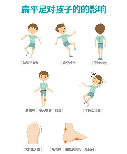 扁平足對孩子的影響