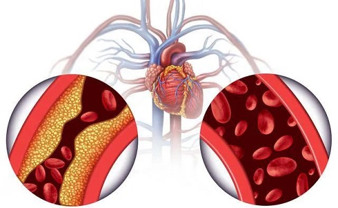 直樂醫院中老年健康篩查