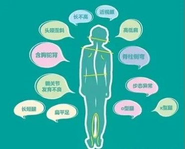 脊柱側彎危害
