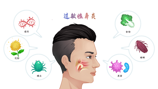 過敏性鼻炎病因